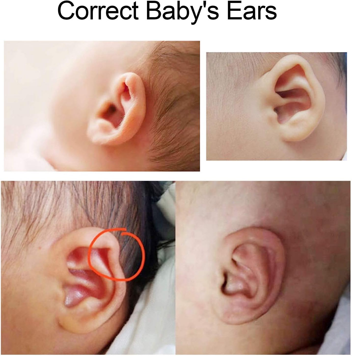 4 x 50cm Silicone Newborn Baby Ear Aesthetic Correctors, Kids Infant Protruding Ear Patch Stickers