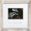 Pearhead Rustic Sonogram Frame, Love at First Sight Ultrasound Frame, Gender Neutral Baby Nursery Décor for Baby Girl or Baby Boy